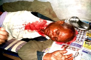 शान्तिपूर्ण धर्नामा प्रहरीद्वारा लाठीचार्ज, दुई दर्जन आन्दोलनकारी पक्राउ, डेढ दर्जन घाइते