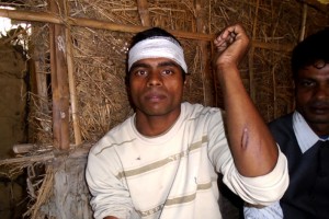 घाइतेहरुको अवस्था बुझ्दै मोर्चाका नेताहरु