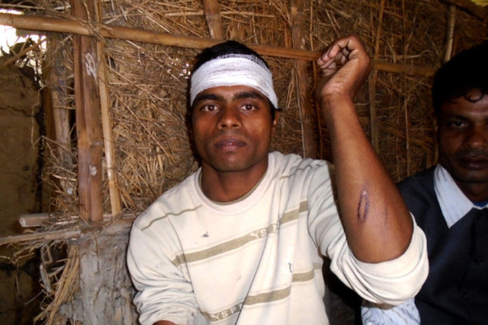 घाइतेहरुको अवस्था बुझ्दै मोर्चाका नेताहरु