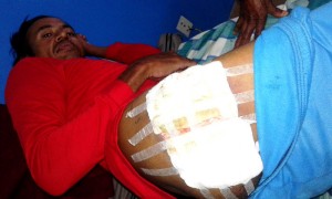 आर्थिक अभावमा आन्दोलनका घाइते पटेलको उपचारमा समस्या