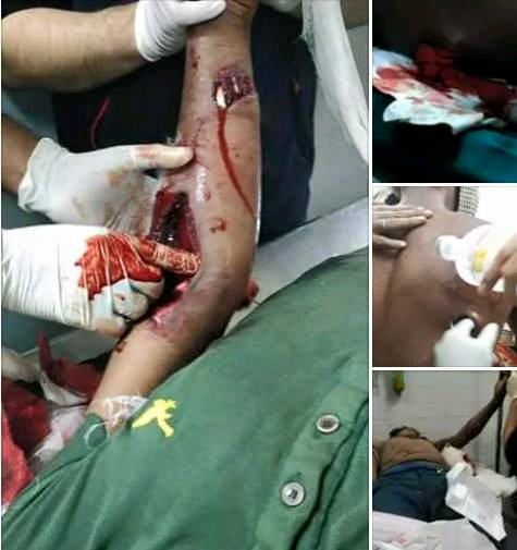 ओली ! अब तेरी वारी है, कब तक मधेश के साथ घोखाधड़ी करोगे ?