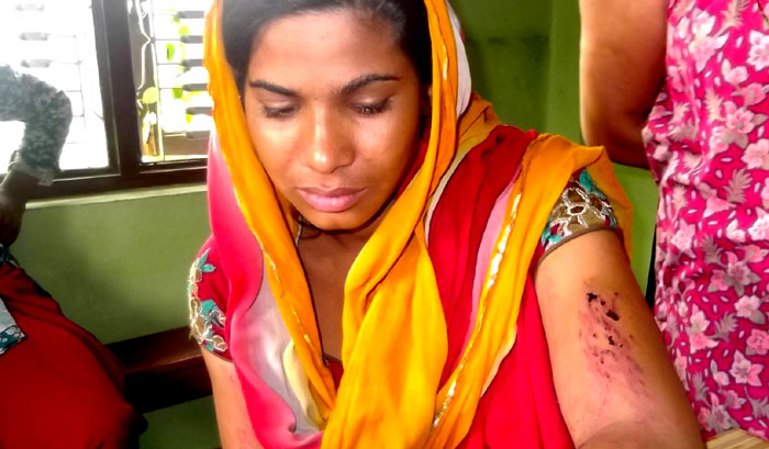 she had beaten badly from both family