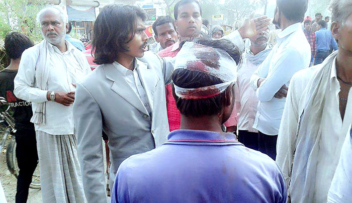 गठबन्धनको शान्तिपूर्ण र्यालीमा प्रहरी हस्तक्षेप, एक दर्जन घाइते, दर्जनौं गिरफ्तार