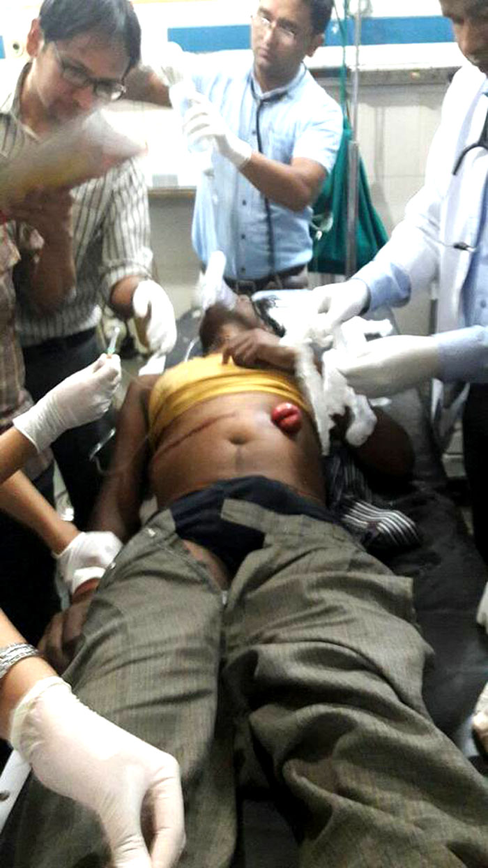 सप्तरी अपडेटः प्रहरीको गोलीबाट मृत्यु हुनेको संख्या चार पुग्यो