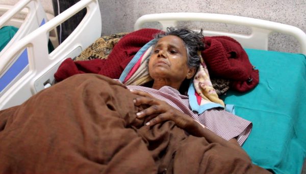 गजेन्द्रनारायण सिंह अस्पतालमा स्तन क्यान्सरको सफल शल्यक्रिया