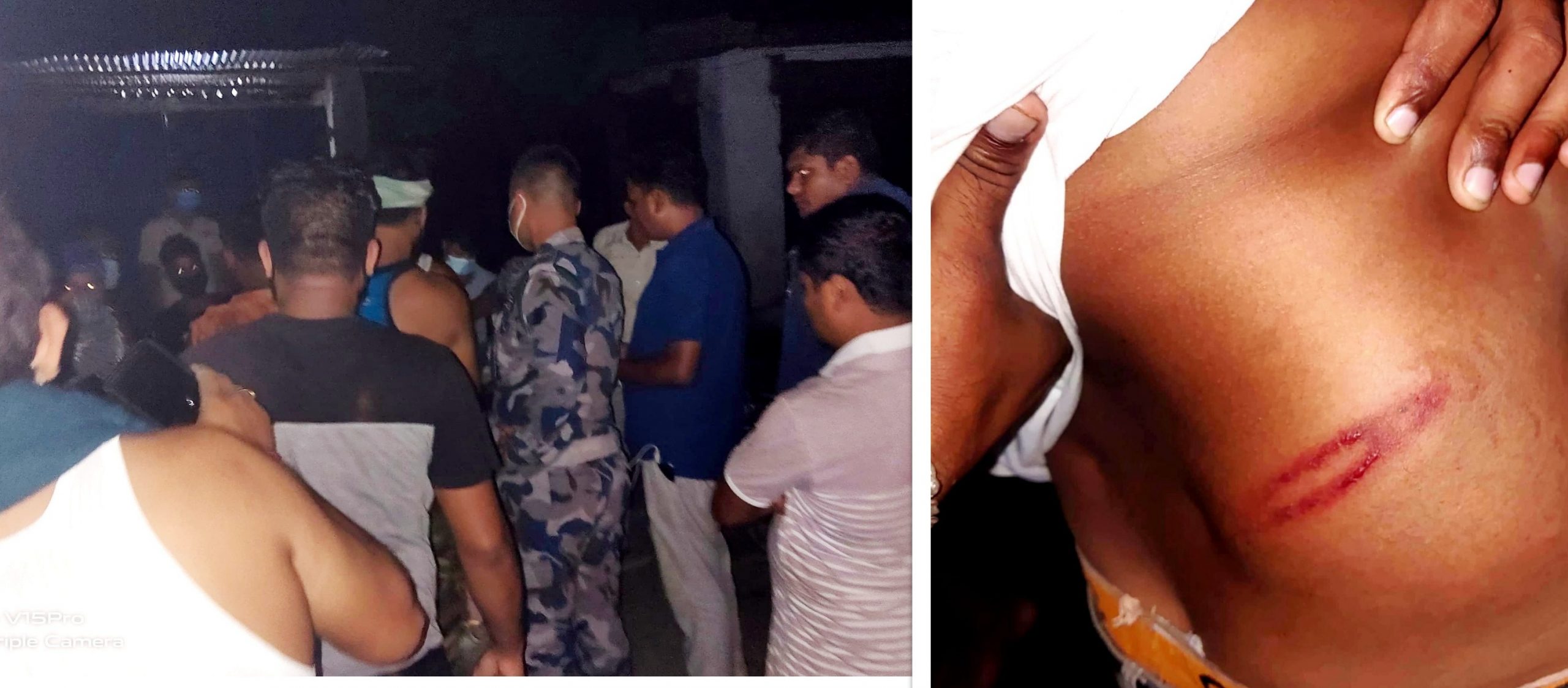 क्वारेन्टाइनमा बसेकाहरुलाई कुट्ने प्रहरीमा कोरोनाको त्रास